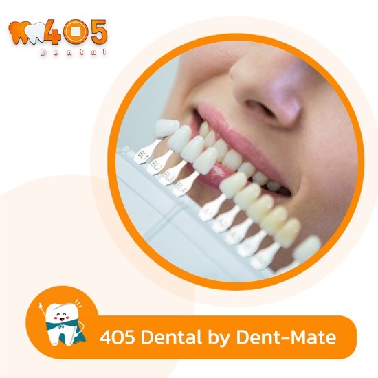 ฟอกฟันขาว เคลือบฟันเซรามิกวีเนียร์ราคาพิเศษ - คลินิกทันตกรรม405 เด็นทัล