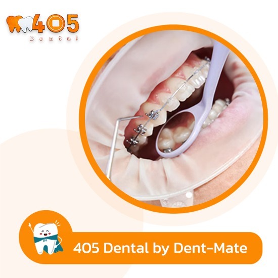 การจัดฟันสำหรับผู้มีปัญหาข้อต่อขากรรไกร - คลินิกทันตกรรม405 เด็นทัล การจัดฟันสำหรับผู้มีปัญหาข้อต่อขากรรไกร - คลินิกทันตกรรม405 เด็นทัล